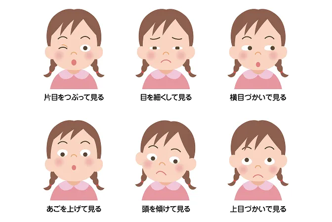 目の症状（乳幼児の視力／弱視の早期発見）